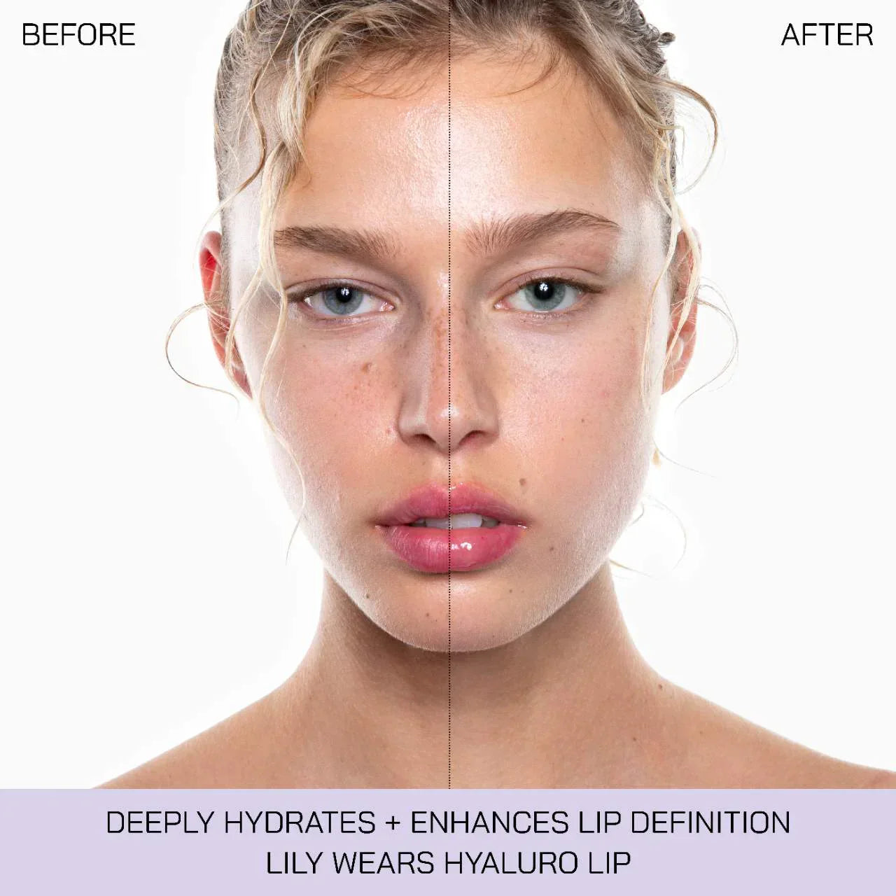 Hyalurolip Lip Plumper with Hyaluronic Acid